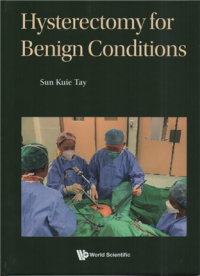 Image of Hysterectomy for benign conditions
