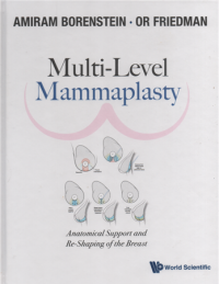 Image of Multi-level mammaplasty : anatomical support and re shaping of the breast